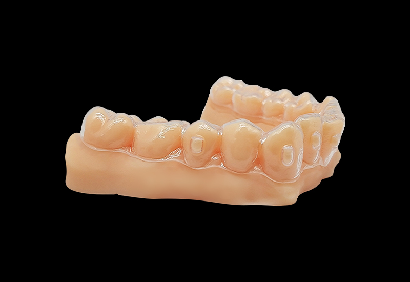 什么是3d打印正畸牙模？3d打印正畸牙模怎么做？